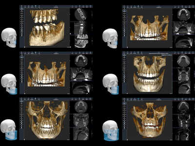 Acteon X-MIND Optima 3D